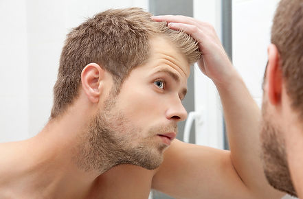 male-hair-loss-article.jpeg