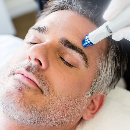 19-hydrafacial-Male-9.jpeg