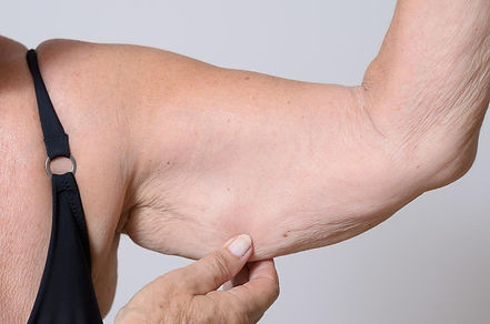 flabby_arm_1000x1000.jpeg