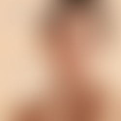 How to Get Glowing Skin Without Scars