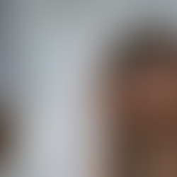 How Can I Get Rid of Blackheads?