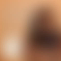 Elevate Your Beauty Journey with ALLE Points: Exclusive Rewards from Allergan Neurotoxin