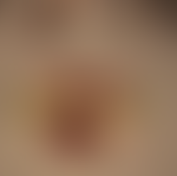 Salad of Norwich Meadows Farm Radishes from Per Se in Manhattan, New York. Three Michelin-star restaurant. Photo from Jabri Fine Dining photographer Emma Jabri, JFD.