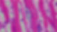Trypanosoma cruzi - nest in heart tissue_edited.jpg