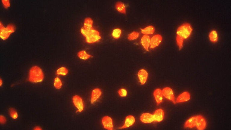 giardiasis.jpeg