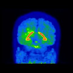 A rotating image of a brain scan. 