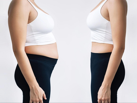 Medi Weight Loss Cape Coral Fl