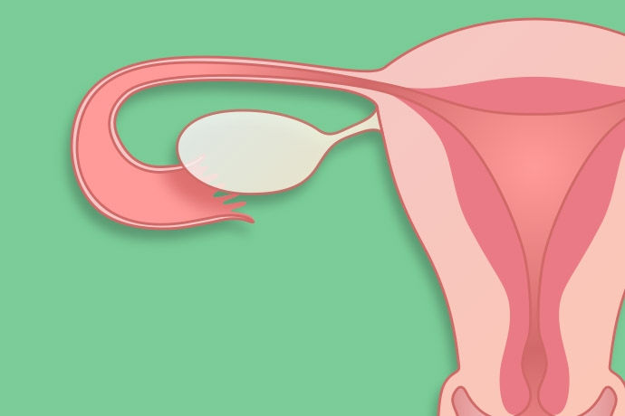 Gynaecology with Dr Ritchie