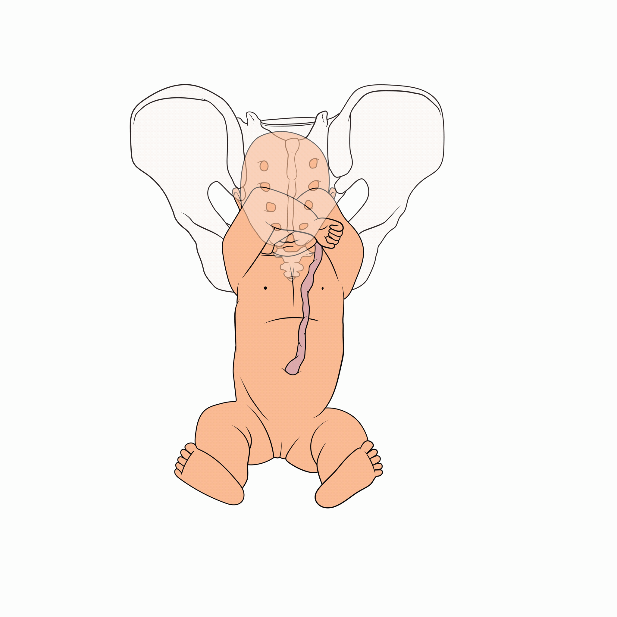 Breech birth module - gif.gif