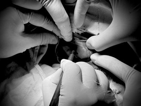 dr shroff's charity eye hospital