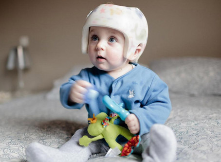 👶🏻Encore trop de bébés à la tête plate
