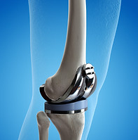 Sanera_Servicios integrales_Ortopedia3.j