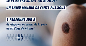 Les cancers cutanés continuent d’augmenter