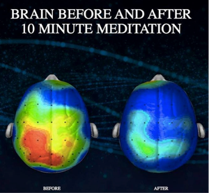 meditation brain relaxation