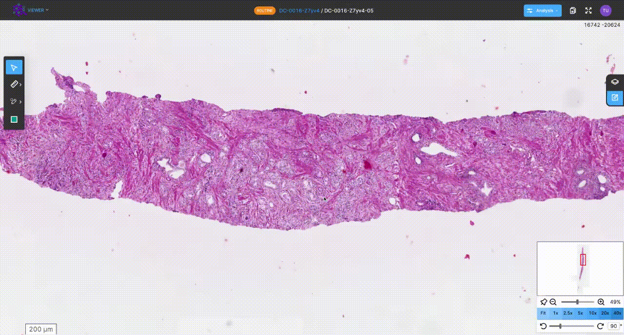 How prostate module works