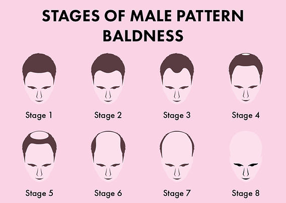 ghk cu male pattern baldness Hair Loss Treatment For Men