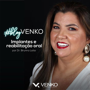 Implantes dentários e reabilitação oral: tudo o que você precisa saber
