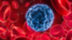 UVBI Therapy | Sarasota, FL