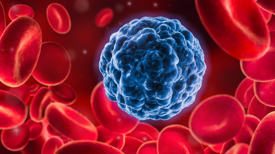 UVBI Therapy | Sarasota, FL