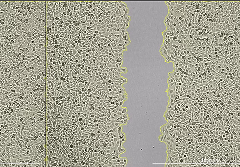 Wound_Healing_Cytogene_Lucknow_edited.png