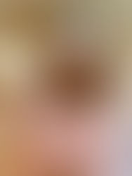 😍Renopho Eye Massager with Heat and Vibration😍