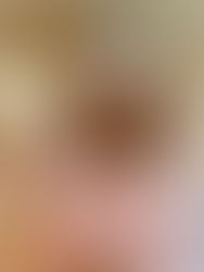 🔥🔥RENPHO Electric Massagers