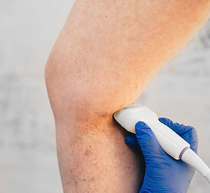 Varicose veins ultrasound