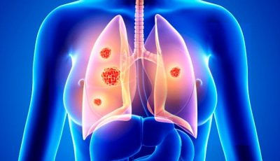 The Deadly Truth About Radon Gas