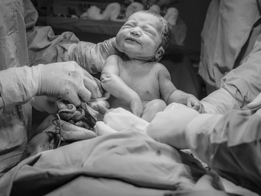 Préparer une césarienne programmée au naturel : une naissance respectée et consciente