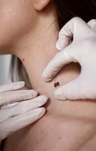 female-doctor-diagnosing-melanoma-body-female-patient-1-768x1150.jpg
