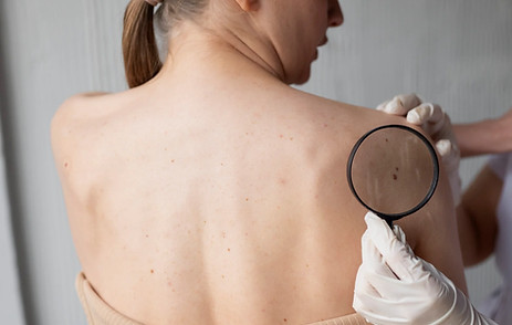 female-doctor-diagnosing-melanoma-body-female-patient-scaled.jpg