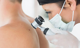 dermatologist-examining-mole-patient-768x512.jpg