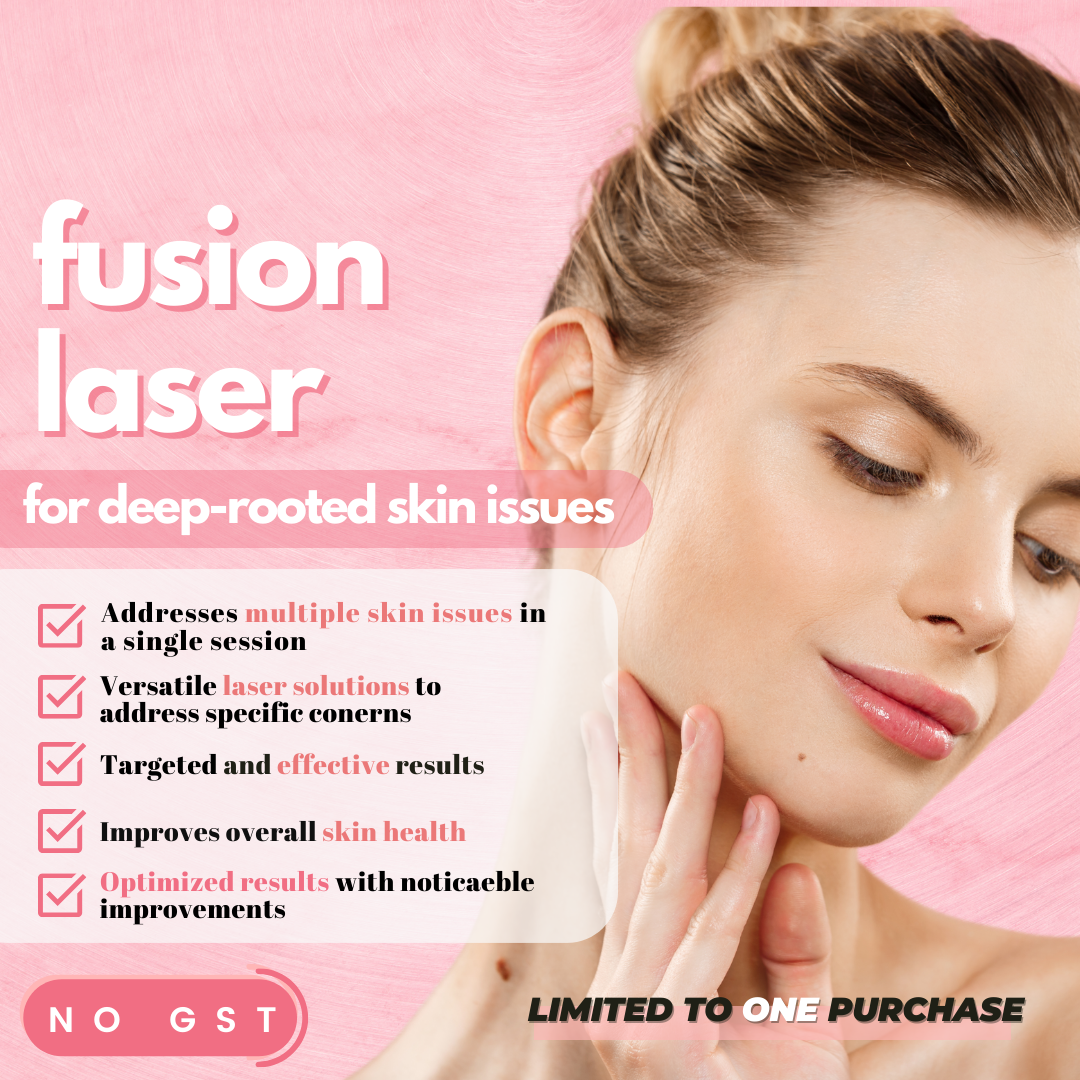 Fusion Laser