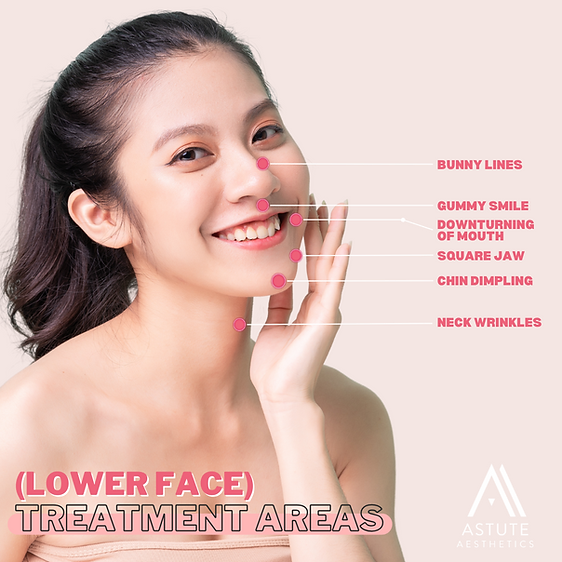 BTX on Lower Areas of face
