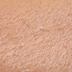 detail-dry-skin-woman-dehydration-due-sun-s-rays-without-uv-protection-cream.jpg
