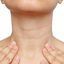 young-woman-touching-her-neck-with-her-hands-isolated-white-background-lines-female-neck.j