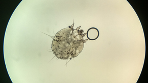 ZiP on ABC News! Scabies diagnostic test in development.