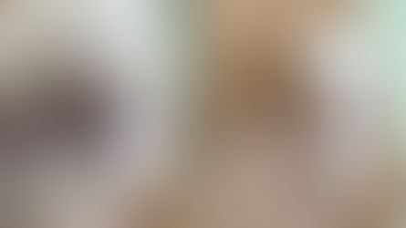 Foto „enne ja pärast“, mis demonstreerib keloidse armi laserravi suurepäraseid tulemusi.