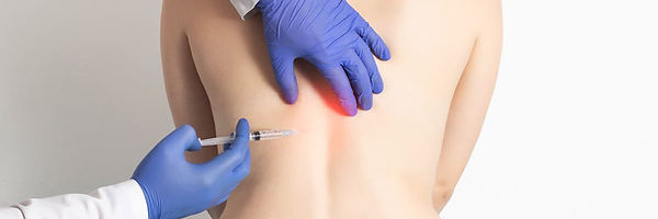 procedimiento estético de la ozonoterapia