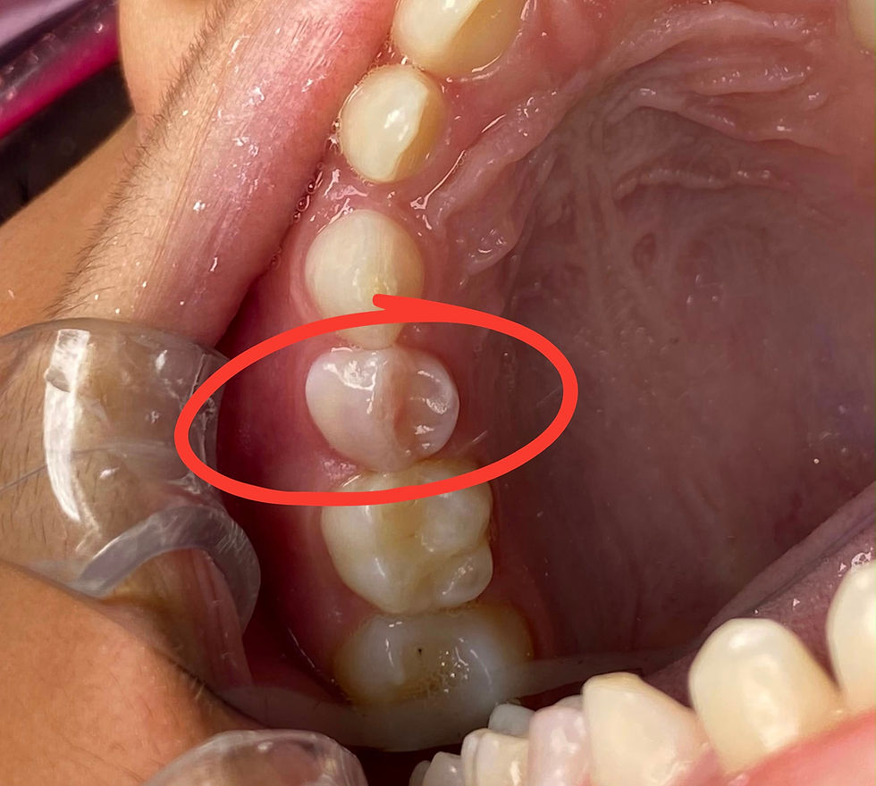 🩷 Seu filho está com um dente de leite rosinha? O que significa?