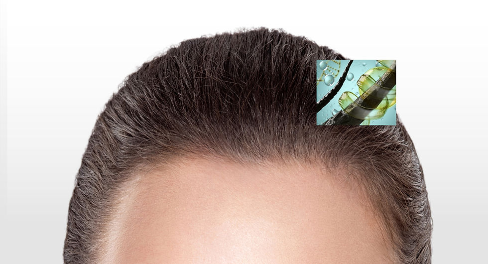 Luxmed, Oeiras, Lisboa, Medicina Capilar, Saúde do Cabelo, Para acelerar a cicatrização, fortalecer os novos folículos e otimizar os resultados do transplante capilar.