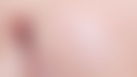 SKin with blackheads