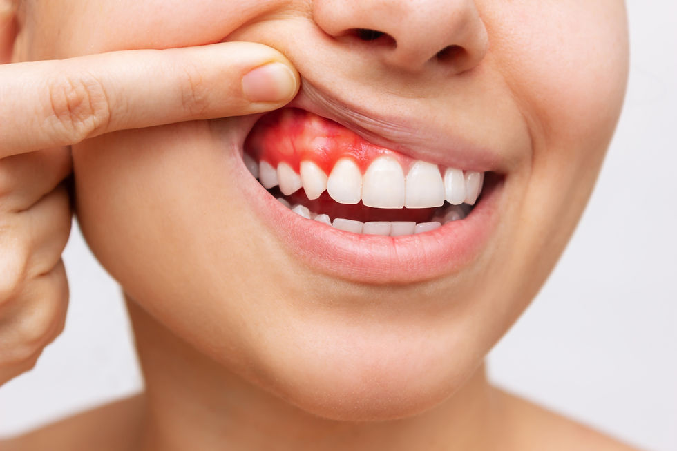 periodoncia en barranquilla.jpg
