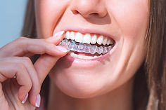 invisalign dra lina pinzón ortodoncista.jpg