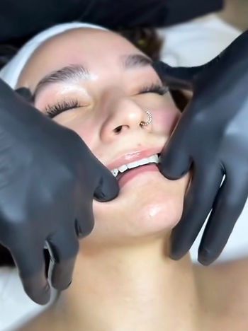 Young woman who is receiving a facial massage and has her mouth stretched open by black gloved hands.