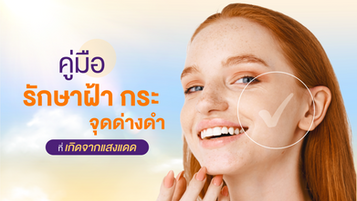 คู่มือรักษาฝ้า กระ จุดด่างดำ ที่เกิดจากแสงแดด