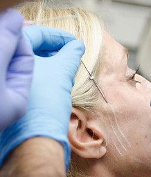 Thread-Lift Training.JPG