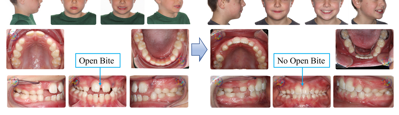 Figure 15.png