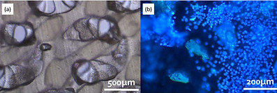 Liver stain.jpg