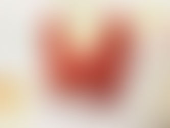 Thyroid Health-Hypothyroidism (Underactive Thyroid) vs. Hyperthyroidism (Overactive Thyroid)